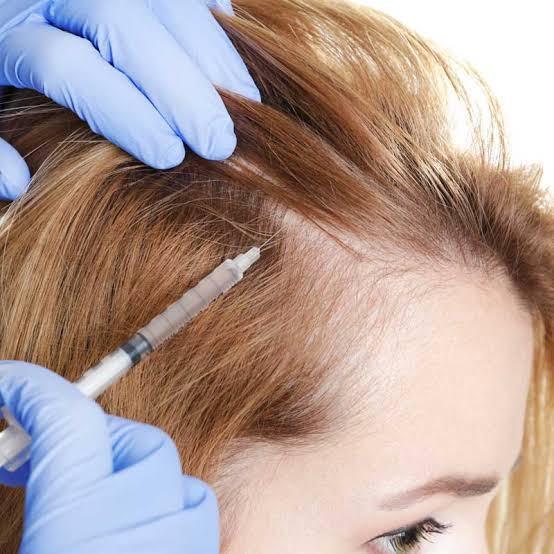 Hair fall alopecia treatment Saharanpur dermatologist clinic